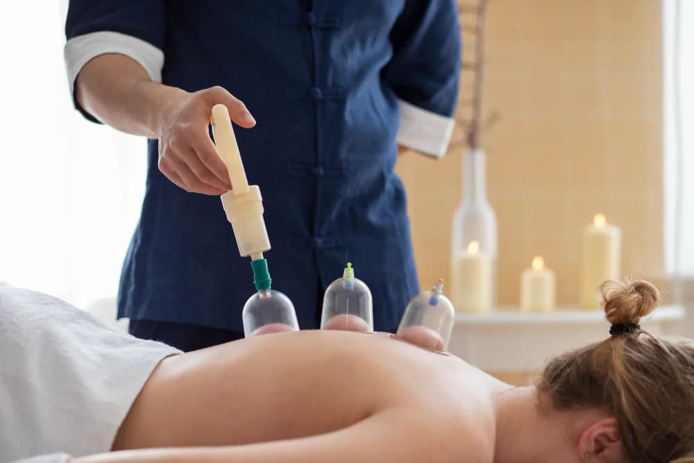 A practitioner places cupping cups on a patient’s back
