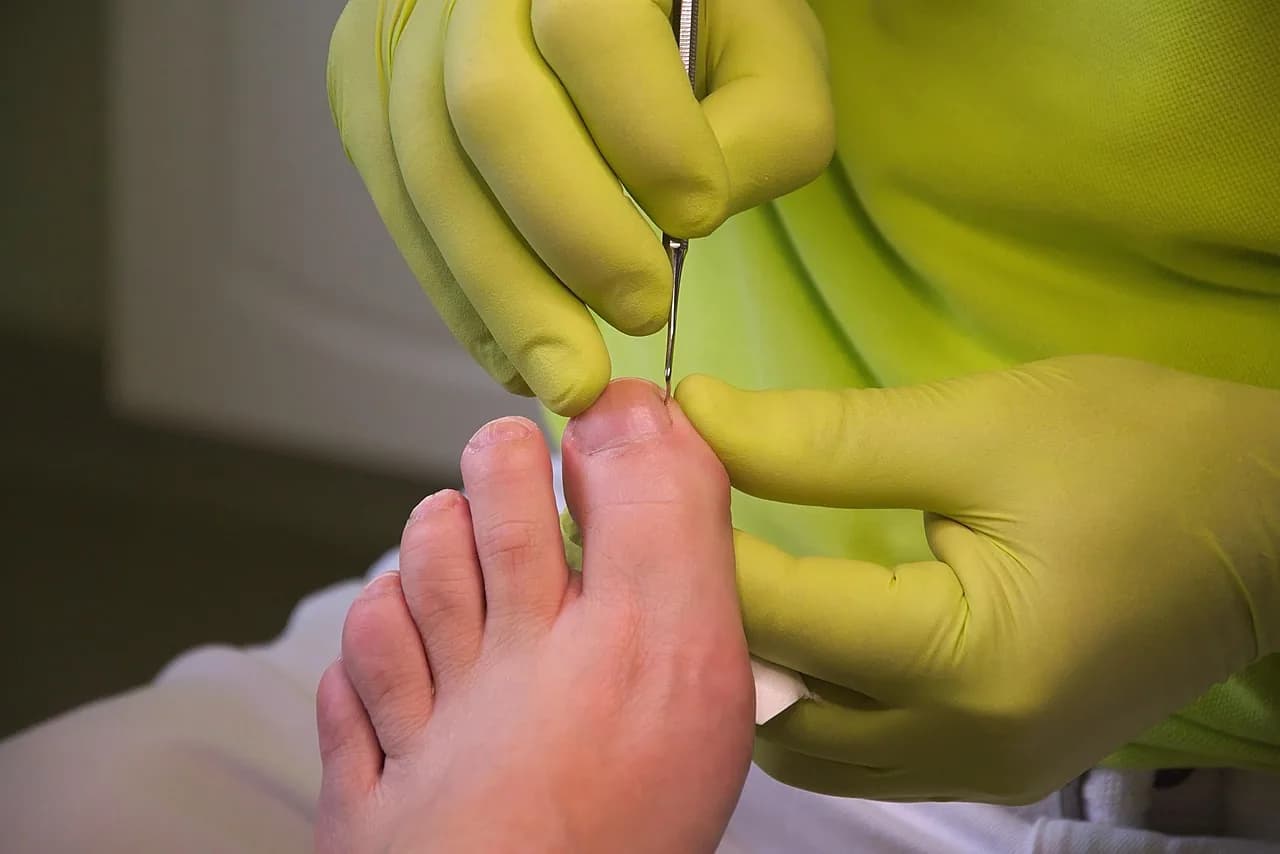 A podiatrist treating a toenail